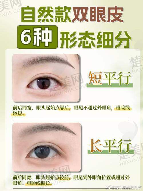 三、东莞缔美游定良医生：个性化方案带来自然美丽