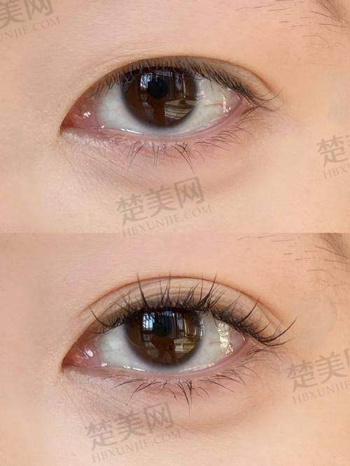 五、东莞西妃刘波医生：专注眼部问题制定优质方案