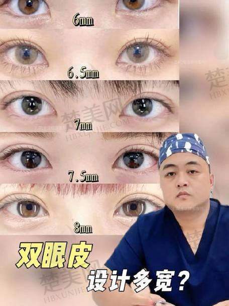 十、东莞星采吕方中医生：医学美学双角度打造理想双眼