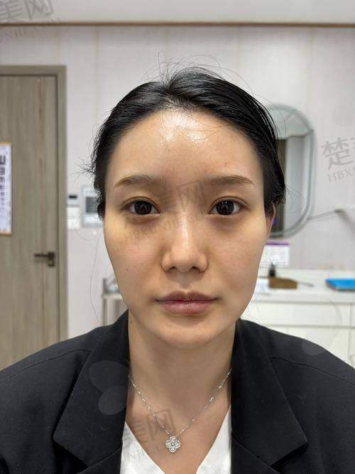 二、常州美贝尔整形美容医院（品牌店）的特色项目
