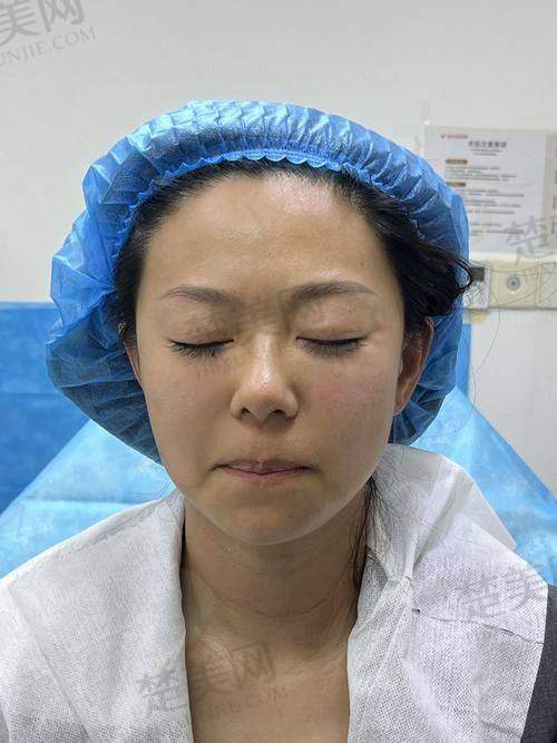四、去除嘴角的法令纹：日常维护小妙招