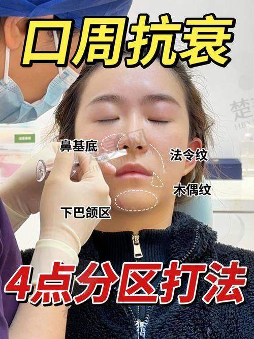 一、去除嘴角的法令纹：成因大揭秘