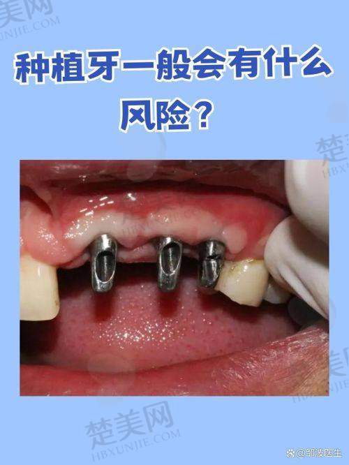 五、广州暨博口腔医院