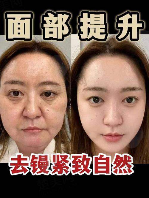 六、祝东升医生：注重综合设计与成效