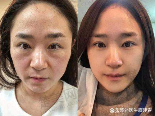 七、宋华敬医生——成都西区医院整形外科的整形精细匠人