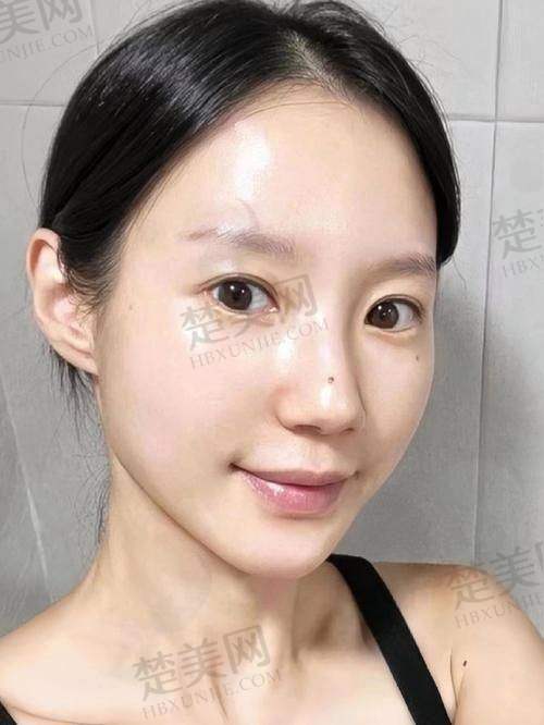 一、成都杨迪医生及其坐诊医院介绍