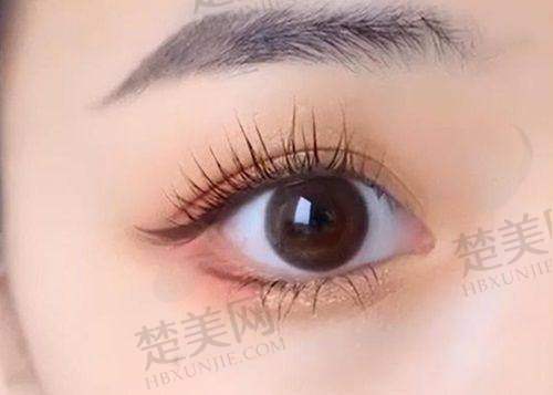一、郑州眼修复医生排名前十名之贺洁医生