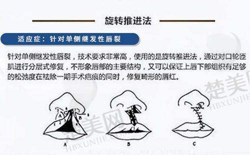 二、达州玛恩医疗美容诊所怎么样？