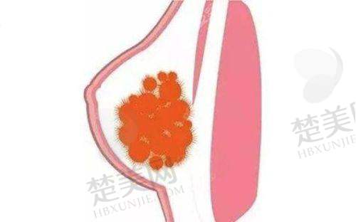 一、广州荔湾区人民医院整形美容中 心——专精清奥的佼佼者