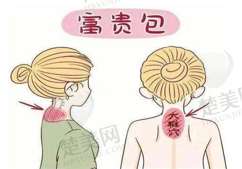 一、温州徐淑卿医生手术实例反馈