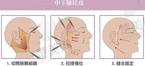 五、总结：湛江韩美——整形的优质之选