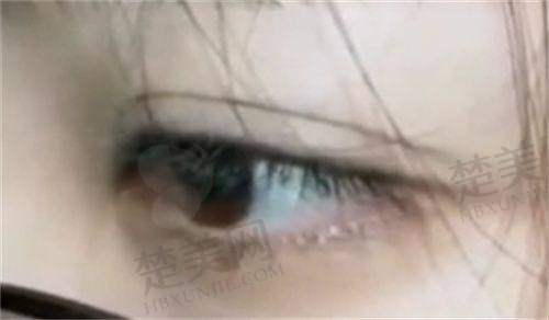 二、惠州梦臻医疗美容门诊部怎么样？