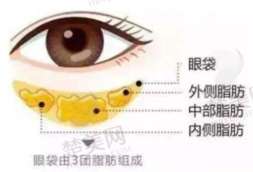 四、2025年王杨医生手术价格表