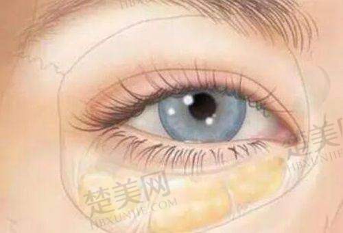 三、广东省人民医院赵成利医生