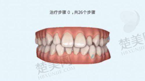 七、恩施益口康虎民路口腔诊所——多种矫正技术并行的诊所