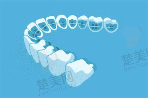 三、恩施咿呀口腔医院——贴心服务与专精技术的结合
