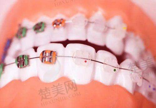 六、其他口腔项目价格