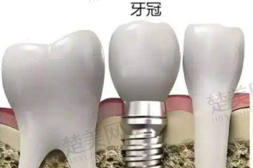 三、燕郊顺德口腔医院——连锁品牌的技术担当