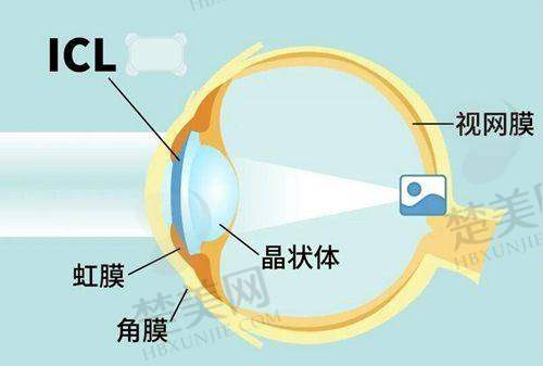 三、徐州一院眼科详细的预约挂号流程