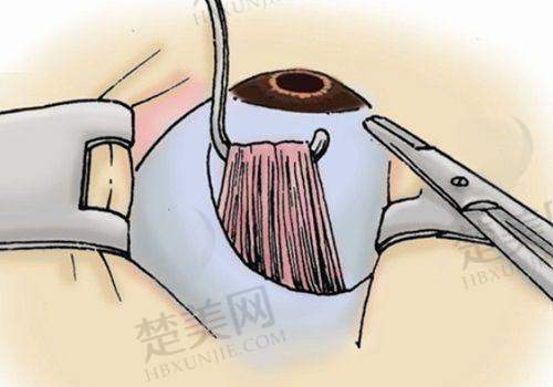 三、佳木斯爱视眼科医院预约挂号方式
