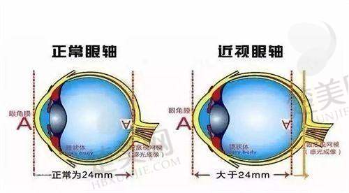 五、哈尔滨华厦眼科医院的价格参考