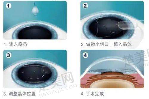 一、镇江华厦眼科医院基本情况