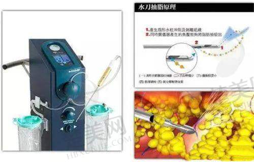 四、惠州梦臻医疗美容门诊部特色项目