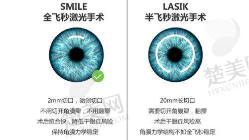 六、兰州普瑞眼科医院营业时间