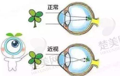五、徐州华厦眼科医院其他眼科治疗怎么样啊