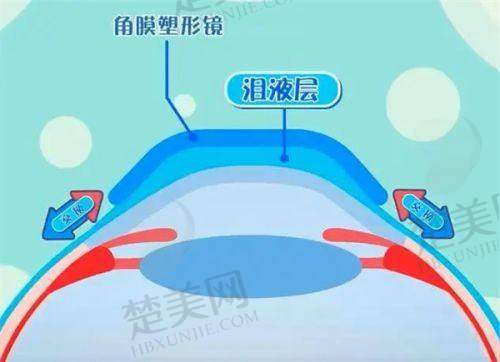 二、北京华德眼科医院:成立早,近视手术经验多
