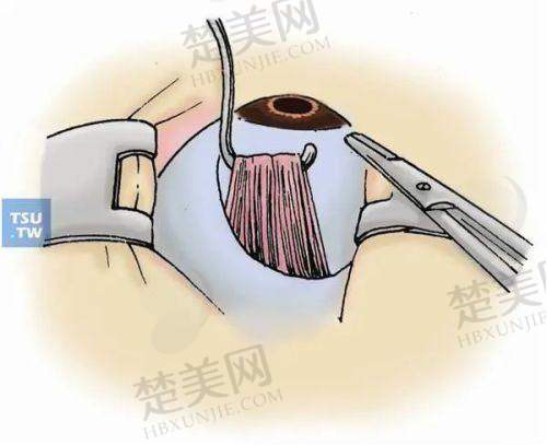 三、哈尔滨华厦眼科医院的医生团队实力