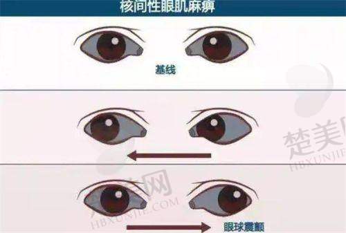 二、乐山爱尔眼科有医生生大推荐