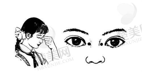 六、成都普瑞眼科医院的服务与口碑