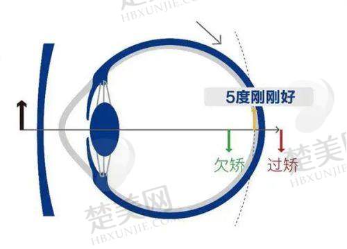 三、徐州复兴眼科医院的服务质量