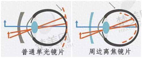 二、石家庄联谊眼科医院地址在哪里——特色诊疗项目