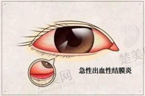 五、兰州普瑞眼科医院的优势