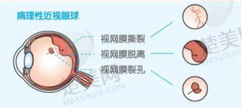 七、临沂费县光明眼科医院其他信息