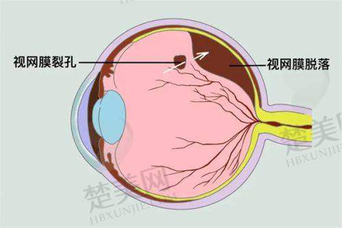 兰州普瑞眼科医院地址在哪里坐几路公车？权威攻略助您轻松找到优质眼科诊疗地