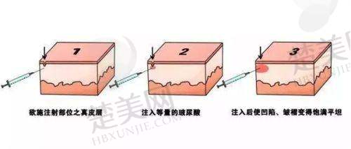 三、深圳市宝安区人民医院整形外科——口碑良好的除皱医院