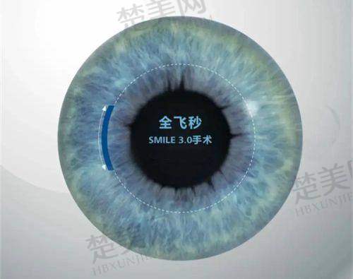 四、兰州普瑞眼科医院预约挂号攻略