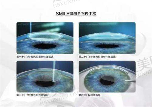 一、徐州复兴眼科医院挂号预约方式