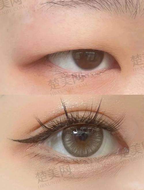 五、郑州眼修复医生排名前十名之杨小顺医生