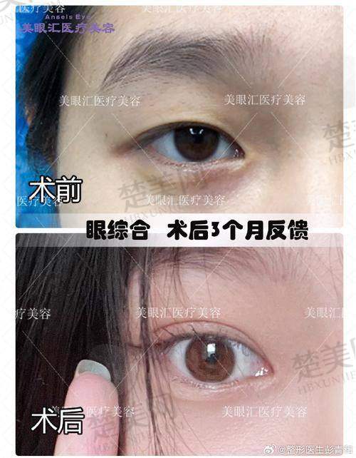 十、蔡灵医生——成都艺星整形美容医院的口碑医生