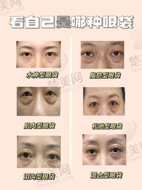 一、南方医 科 大学南方医院鲁峰医生