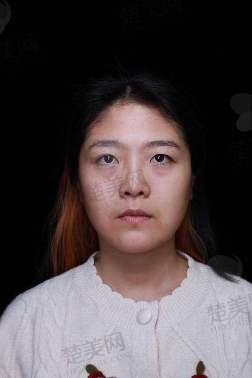 六、真实患者经验分享（避坑指南）