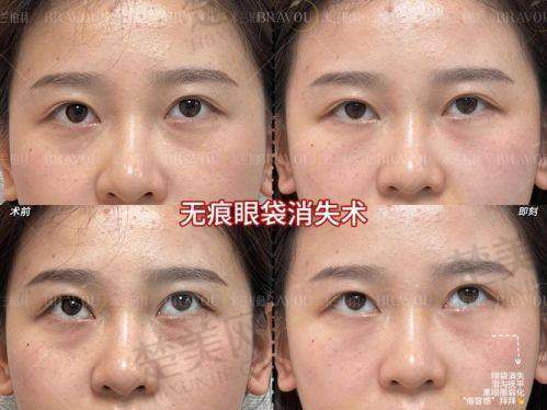 五、术后护理必须知道的5件事