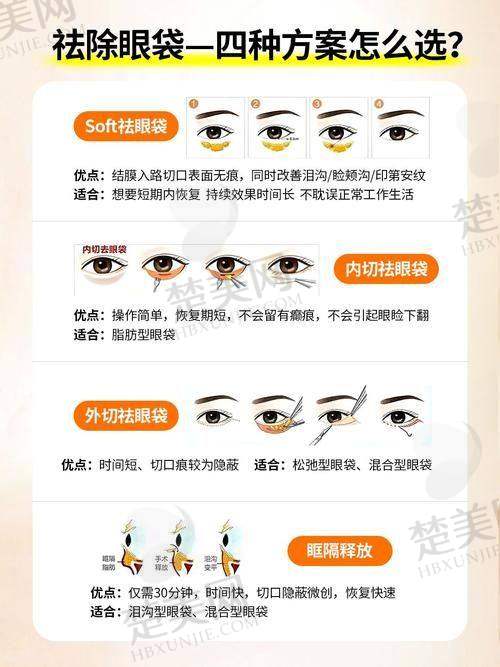 一、广州去眼袋好的医生排名第一可能是谁——鲁峰医生