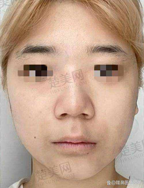 五、深圳李俊医生的求美者评价