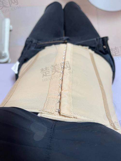 一、广州手术吸脂医院排名前十国有医院推荐