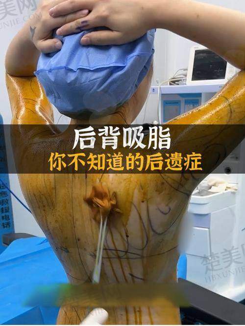 二、成都朱慧东医生擅长项目及技术优势